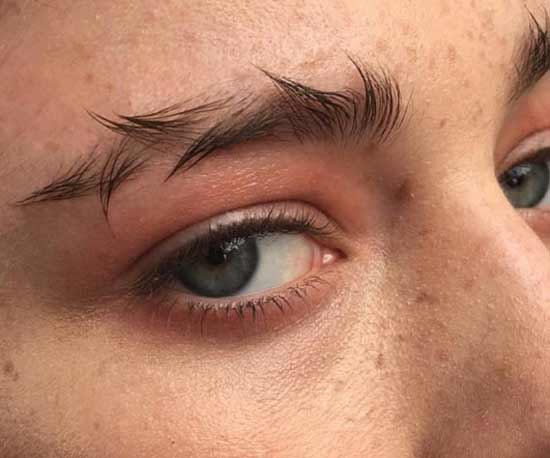Sourcils épineux